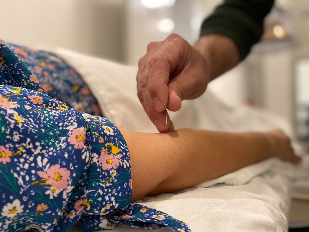 Forstå betydningen af akupunktur i dagens behandling
